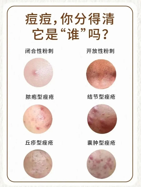 金3.jpg