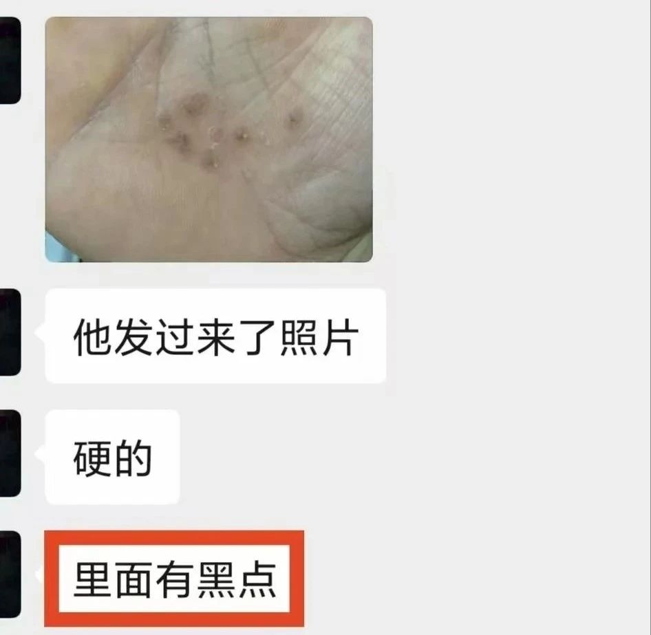 瀘州男子手上長出……