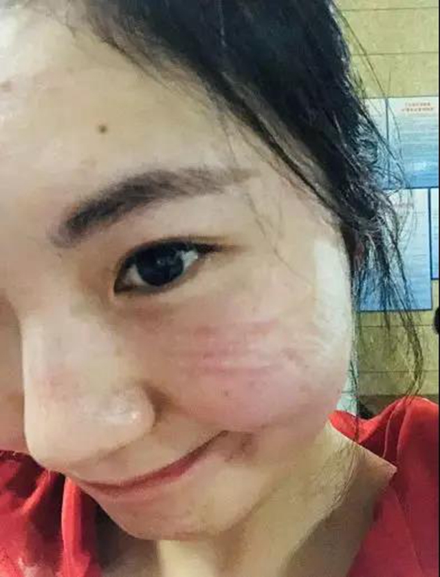 宜賓江安確診患者治愈出院！10名醫(yī)護(hù)人員解除隔離(圖5)