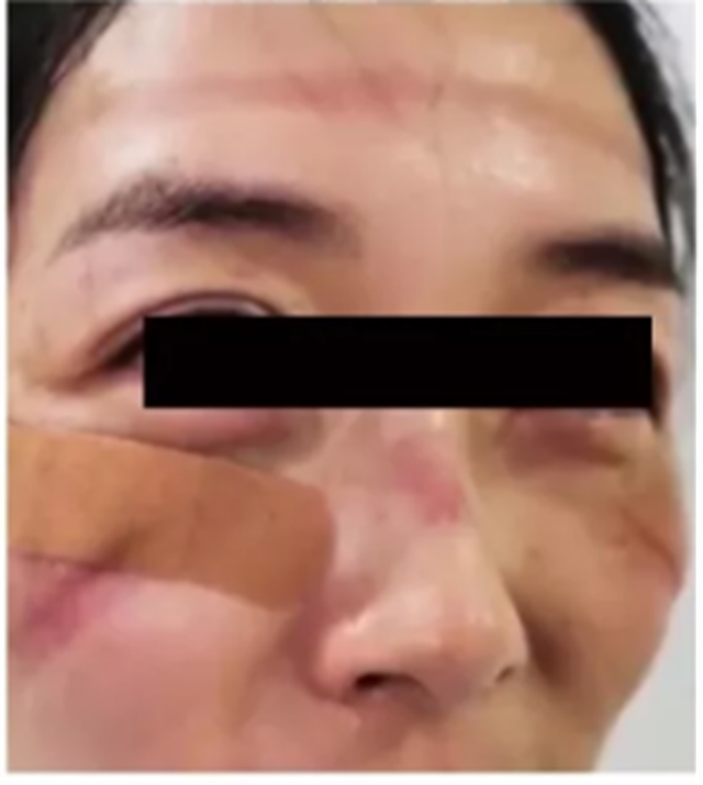 【西南醫(yī)大附院皮膚科?美貌秘籍】學(xué)會(huì)這些，呵護(hù)你口罩下的美麗！(圖3)