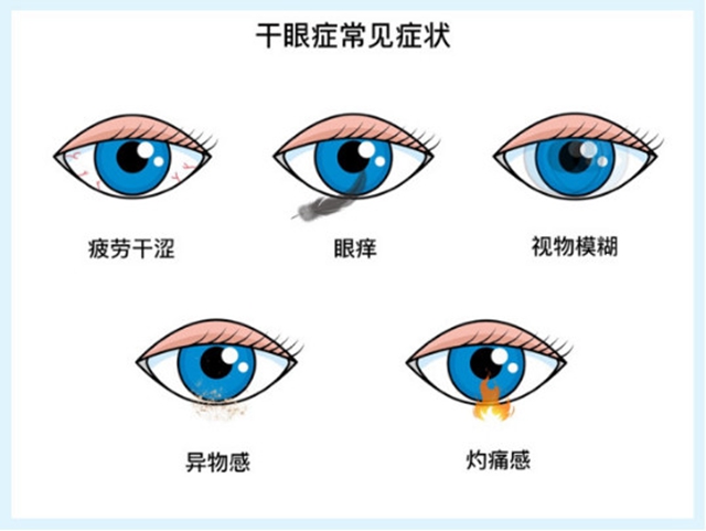 西南醫(yī)大附院專家提醒：抗擊新冠家里蹲，護(hù)眼常識(shí)需謹(jǐn)遵
