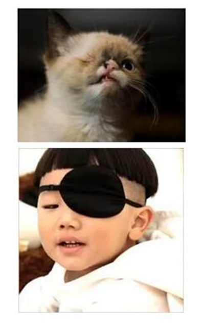 【險情】鐵屑飛進眼睛，男子差點失明！