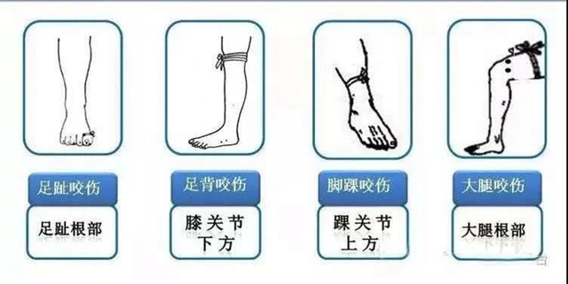 【圍觀】毒蛇造訪家中，瀘州兩男子被咬傷入院(圖9)