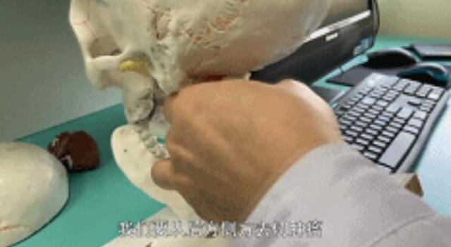 開始只是手指發(fā)麻，一查竟是顱內(nèi)腫瘤！差點(diǎn)就癱瘓……(圖4)