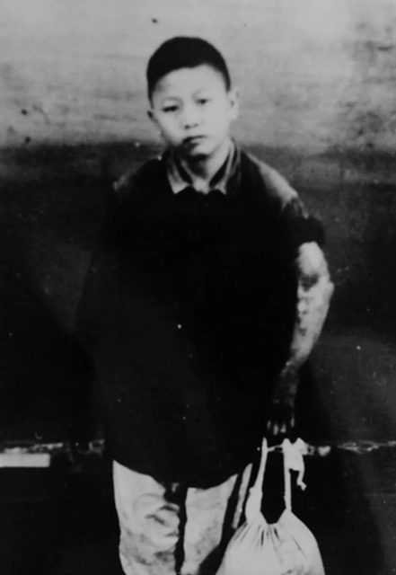 【歲月流金·70年史跡】各種高難度手術(shù)，70年代西南醫(yī)大附院已名揚(yáng)四海(圖5)