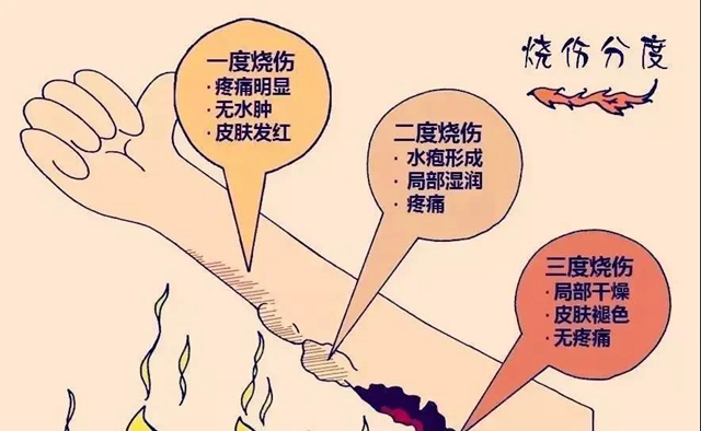 【關(guān)注】男子被10萬伏高壓電燒焦？(圖4)