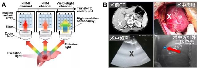 西南醫(yī)大附院肝膽外科新技術登上SCI期刊封面(圖1)