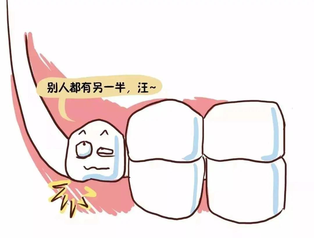 【擴(kuò)散】智齒，到底該不該拔？(圖5)