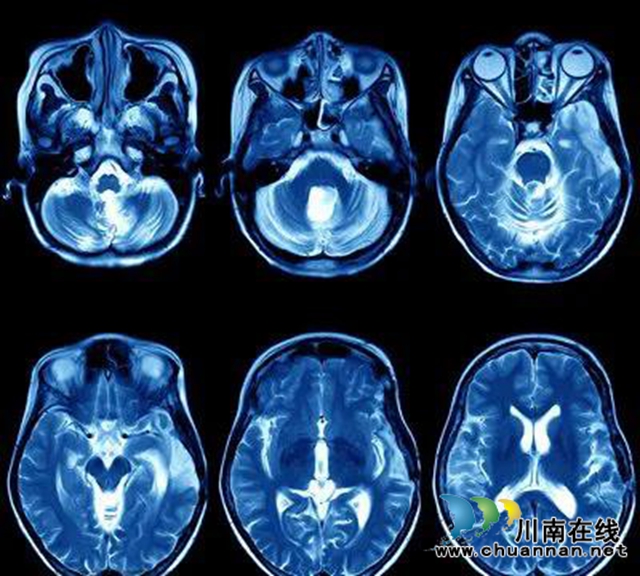 它來啦！“這個大物件”即將在瀘州骨病醫(yī)院投入使用(圖4)