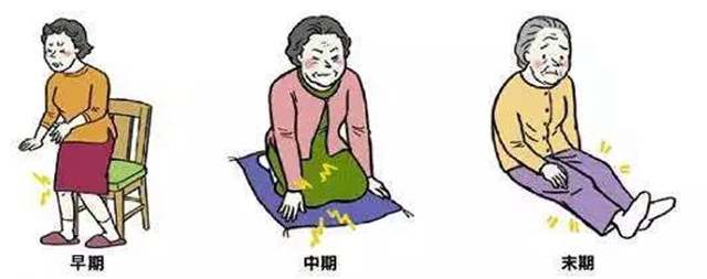 長(zhǎng)假即將結(jié)束，發(fā)現(xiàn)膝關(guān)節(jié)腫脹、關(guān)節(jié)炎怎么辦？(圖3)
