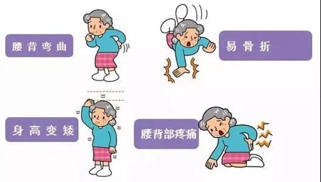 【擴散】只要1分鐘，測測你患骨質(zhì)疏松的風險？