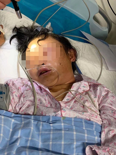 【圍觀】毒蛇不冬眠？瀘州2人被偷襲入院……(圖4)