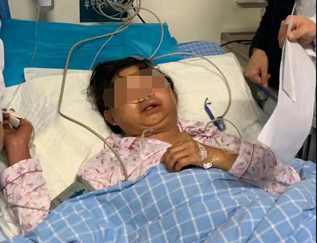 【圍觀】毒蛇不冬眠？瀘州2人被偷襲入院……(圖5)
