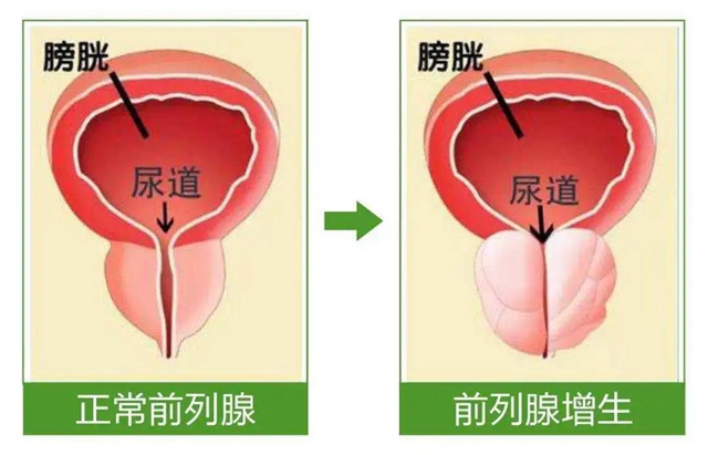 【關(guān)注】93歲大爺?shù)摹澳小毖灾[？差點(diǎn)……(圖7)