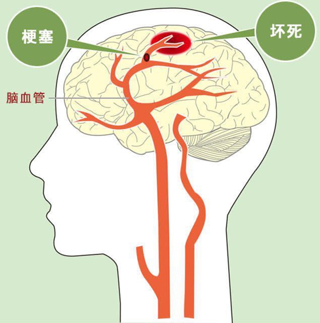 【冬季高發(fā)】6個(gè)危險(xiǎn)信號(hào)一定要警惕！(圖4)