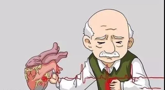 【好消息】降價(jià)了！冠脈支架安裝只需幾百元？