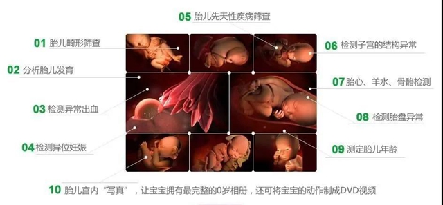 【擴(kuò)散】害怕寶寶先天畸形？這項(xiàng)檢查不可忽視！(圖5)