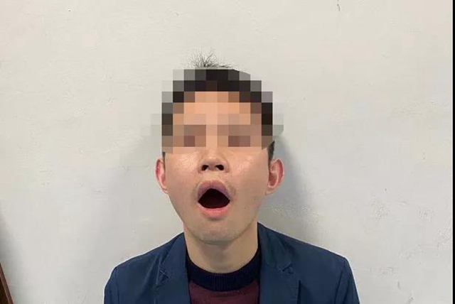 打個(gè)哈欠，瀘州男子“合不攏嘴”了……