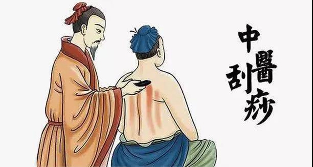 【注意】你對刮痧感興趣？但這些人千萬別刮！
