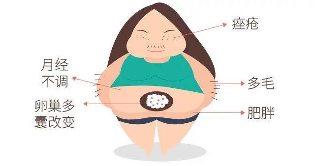 【提醒】女性多毛、月經(jīng)紊亂、痤瘡，當心得了這個?。?圖2)