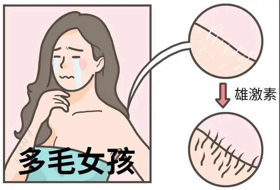 【提醒】女性多毛、月經(jīng)紊亂、痤瘡，當心得了這個??！(圖6)