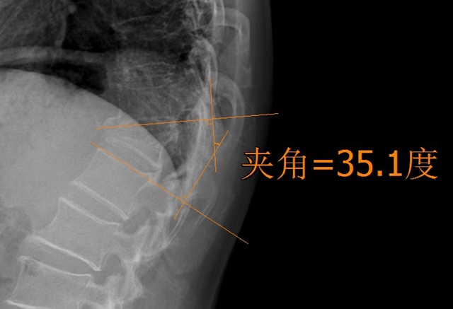 【圍觀】瀘州又一52歲孃孃，更厲害了！(圖3)