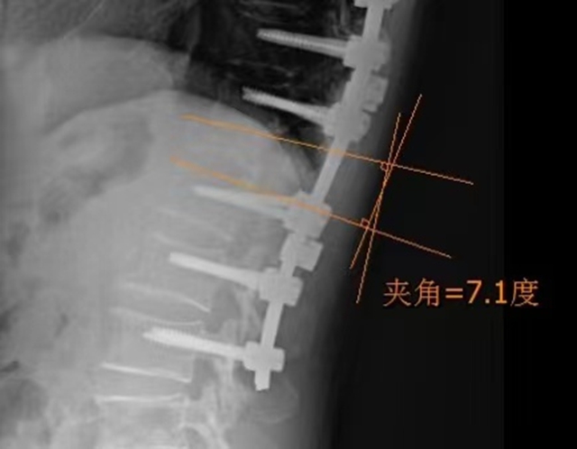 【圍觀】瀘州又一52歲孃孃，更厲害了！(圖6)