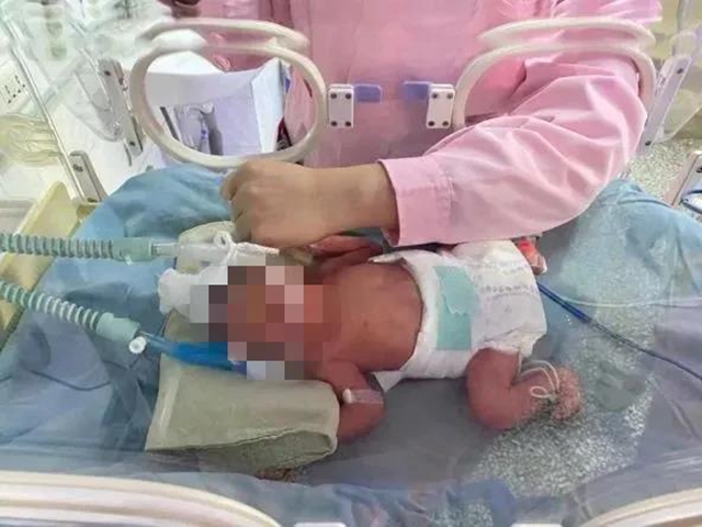 生命“闖關”！隆昌這家醫(yī)院拯救了一對龍鳳胎早產兒(圖2)