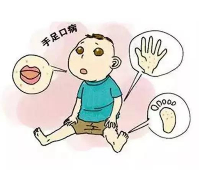7月，瀘州市民要關(guān)注這些疾??！(圖6)