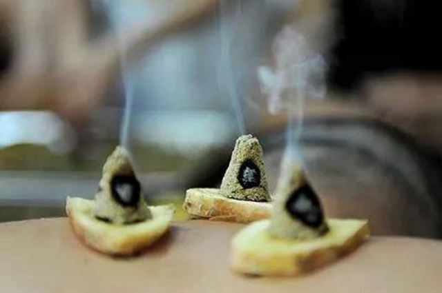 冬病夏治，正當(dāng)時(shí)！ 瀘州市中醫(yī)院喊您來(lái)貼“三伏灸”啦！