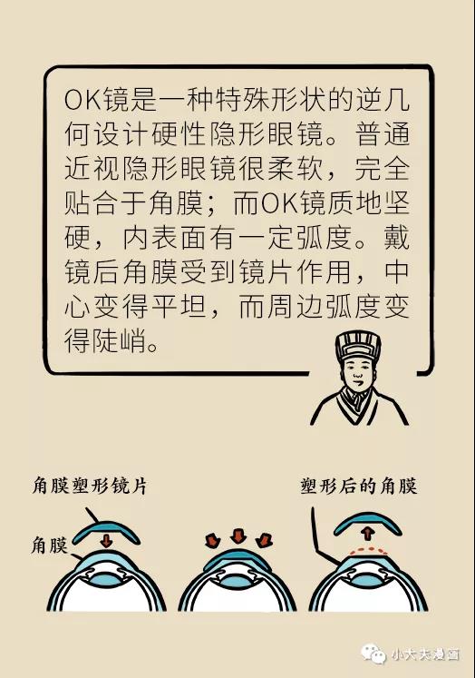 暑假到，配鏡忙，OK鏡真能緩解孩子近視？看專家解答(圖7)