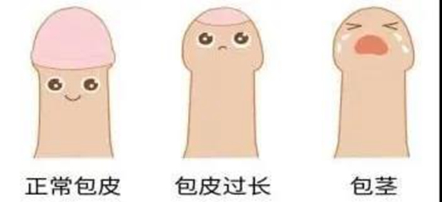 暑期——小兒包皮手術(shù)的最佳時(shí)機(jī)，您可千萬別錯(cuò)過！