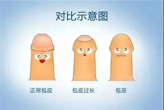 【圍觀】真猛！男子竟自己割包皮？(圖11)