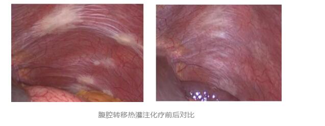 【關(guān)注】43℃高溫下，被燙死了……(圖8)