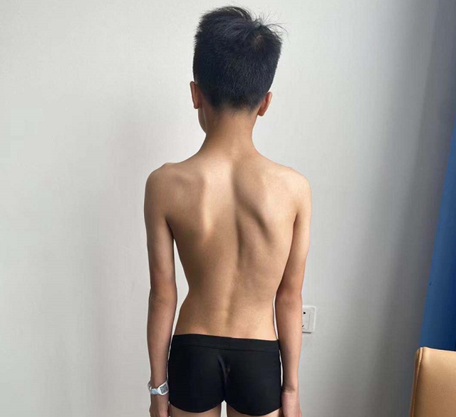 【擴(kuò)散】瀘州12歲男孩為何突然長(zhǎng)高3公分？(圖4)