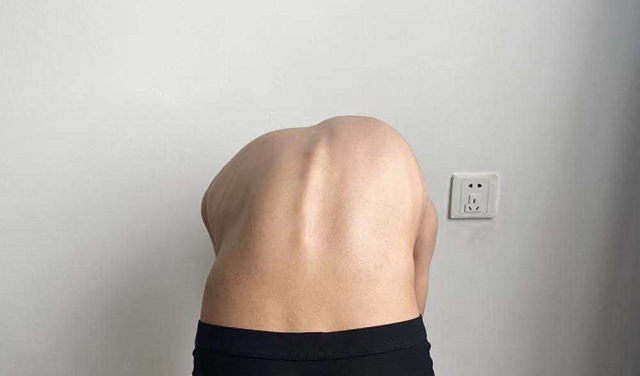 【擴(kuò)散】瀘州12歲男孩為何突然長(zhǎng)高3公分？(圖5)