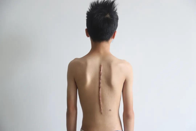 【擴(kuò)散】瀘州12歲男孩為何突然長(zhǎng)高3公分？(圖7)