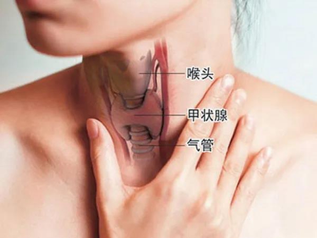 【關(guān)注】這個(gè)“善良的癌癥”，女性發(fā)病率是男性的3倍！(圖3)
