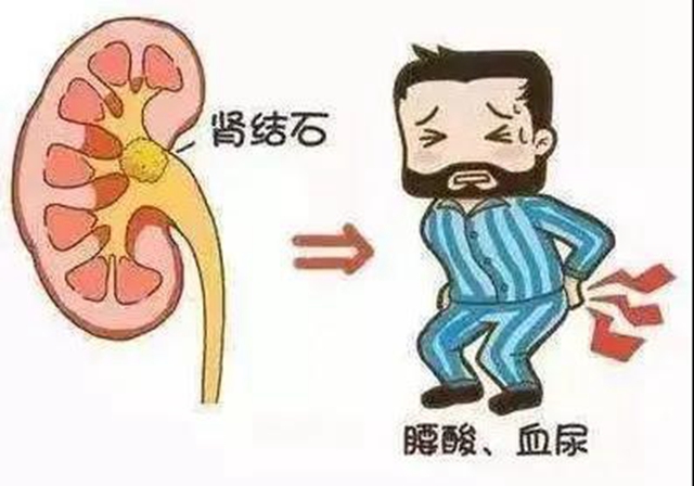 【圍觀】“植物偉哥”——秋葵，吃了真的能壯陽(yáng)？(圖6)