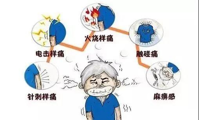 兩月“纏腰丹”fēi痛，一夕微創(chuàng)術治愈(圖3)