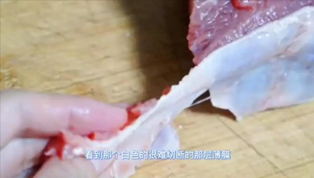 52歲大哥餓了想吐竟是腸癌 、81歲大爺70余刀挽回性命……這件事太重要！(圖9)