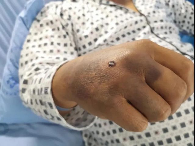 13人慘遭意外襲擊，如果你遇到了要這樣自救(圖1)