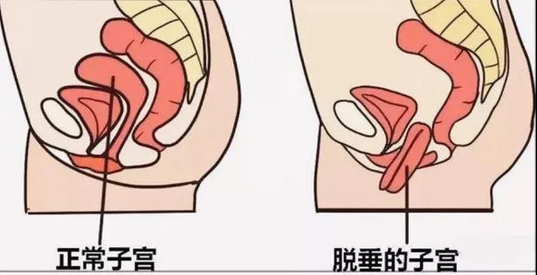 【擴散】88歲老奶奶下體掉了塊“肉”？(圖3)
