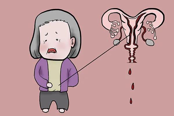 【擴散】88歲老奶奶下體掉了塊“肉”？(圖5)