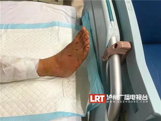 18人被咬傷住院！“烙鐵頭”出沒，瀘州人小心