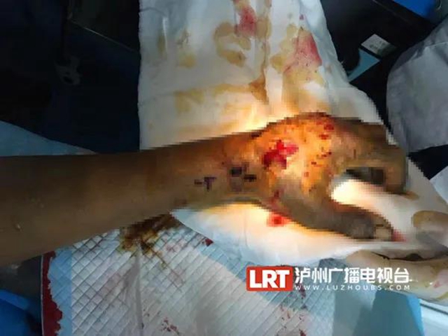 18人被咬傷住院！“烙鐵頭”出沒(méi)，瀘州人小心(圖4)