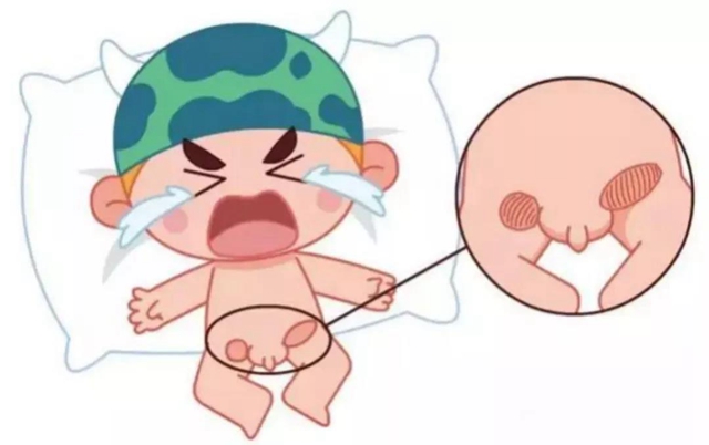 【擴(kuò)散】孩子哭鬧后大腿根鼓個(gè)包？居然是……