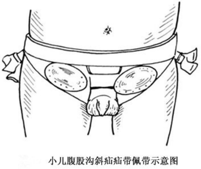 【擴(kuò)散】孩子哭鬧后大腿根鼓個(gè)包？居然是……(圖7)