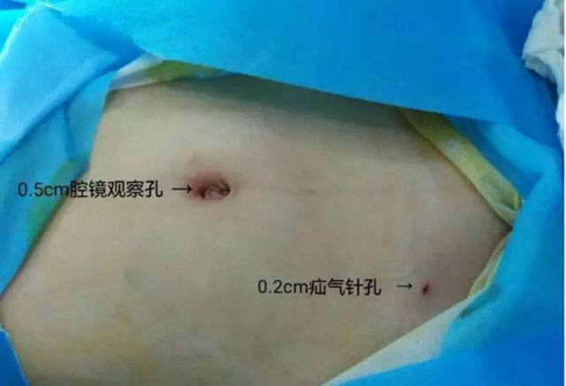 【擴(kuò)散】孩子哭鬧后大腿根鼓個(gè)包？居然是……(圖9)