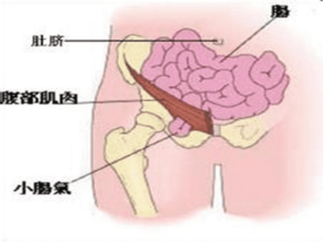 【擴(kuò)散】孩子哭鬧后大腿根鼓個(gè)包？居然是……(圖3)
